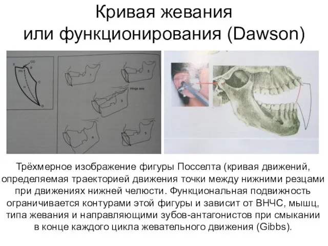 Кривая жевания или функционирования (Dawson) Трёхмерное изображение фигуры Посселта (кривая движений, определяемая