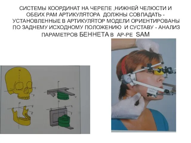 СИСТЕМЫ КООРДИНАТ НА ЧЕРЕПЕ ,НИЖНЕЙ ЧЕЛЮСТИ И ОБЕИХ РАМ АРТИКУЛЯТОРА ДОЛЖНЫ СОВПАДАТЬ