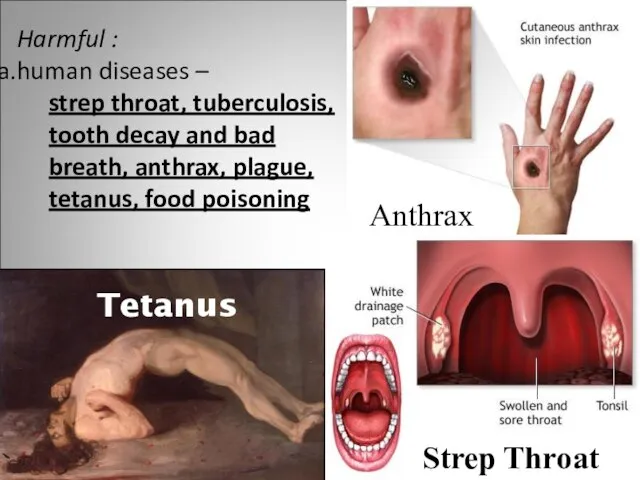 Harmful : human diseases – strep throat, tuberculosis, tooth decay and bad