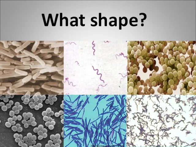 coccus bacillus spirillum coccus spirillum bacillus What shape?