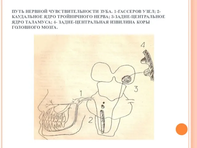ПУТЬ НЕРВНОЙ ЧУВСТВИТЕЛЬНОСТИ ЗУБА. 1-ГАССЕРОВ УЗЕЛ; 2-КАУДАЛЬНОЕ ЯДРО ТРОЙНИЧНОГО НЕРВА; 3-ЗАДНЕ-ЦЕНТРАЛЬНОЕ ЯДРО