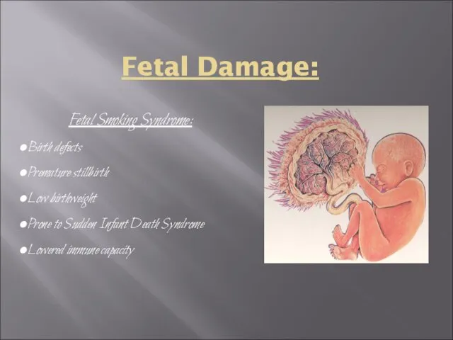 Fetal Damage: Fetal Smoking Syndrome: Birth defects Premature stillbirth Low birthweight Prone