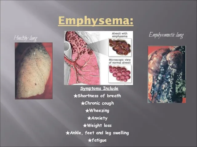 Emphysema: Healthy lung Emphysematic lung Symptoms Include Shortness of breath Chronic cough