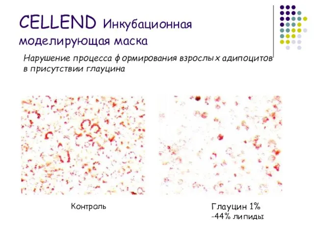 Нарушение процесса формирования взрослых адипоцитов в присутствии глауцина Контроль Глауцин 1% -44%