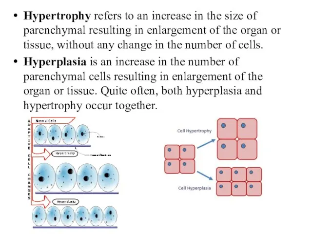 Hypertrophy refers to an increase in the size of parenchymal resulting in