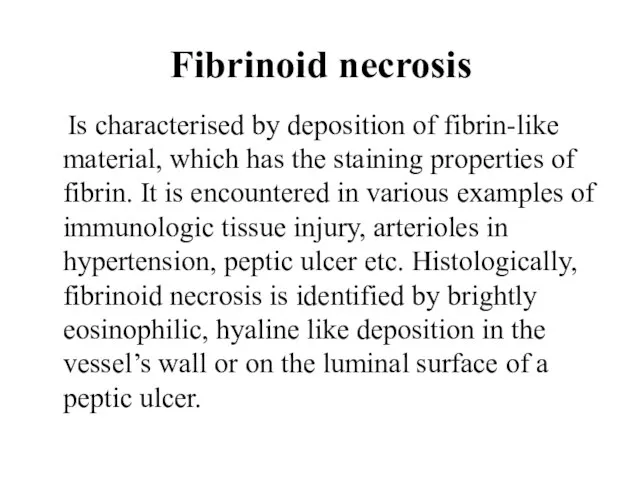 Fibrinoid necrosis Is characterised by deposition of fibrin-like material, which has the