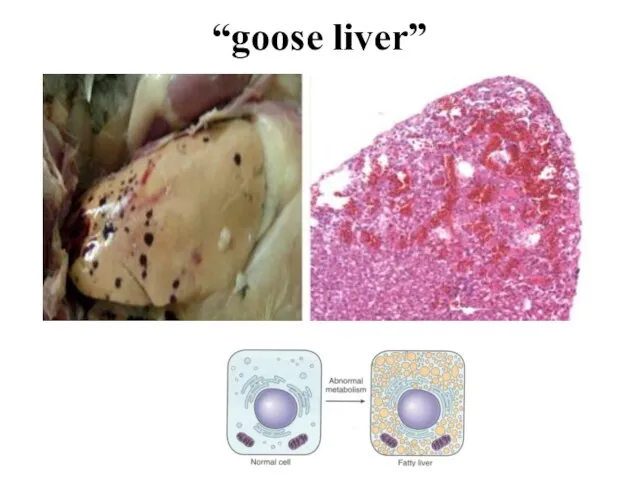 “goose liver”