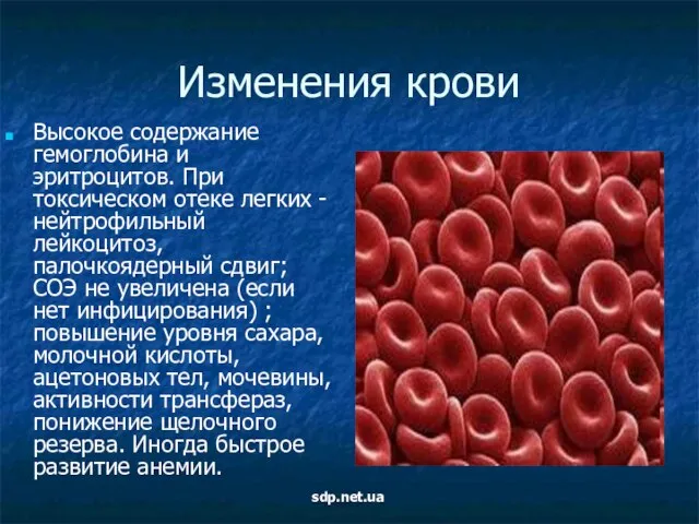 Изменения крови Высокое содержание гемоглобина и эритроцитов. При токсическом отеке легких -