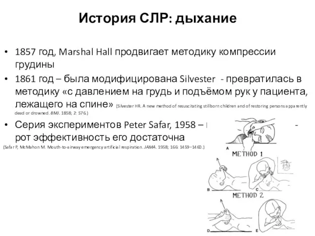 История СЛР: дыхание 1857 год, Marshal Hall продвигает методику компрессии грудины 1861