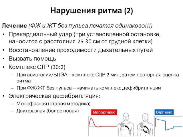 Нарушения ритма (2) Лечение (ФЖ и ЖТ без пульса лечатся одинаково!!!) Прекардиальный