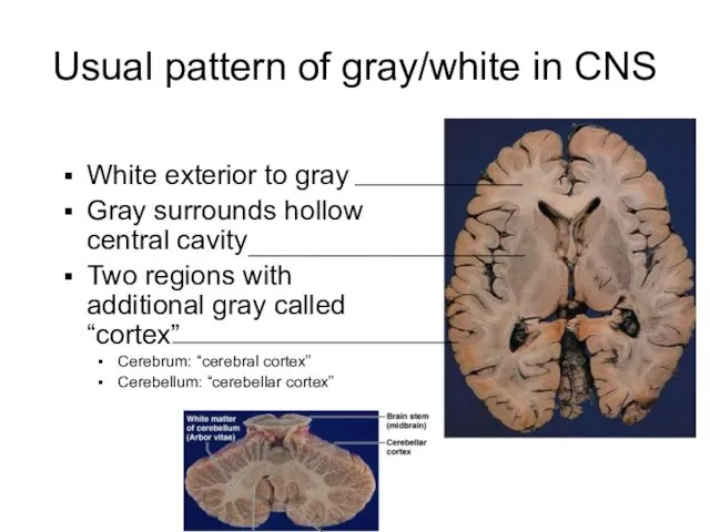 Usual pattern of gray/white in CNS White exterior to gray Gray surrounds