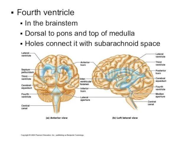 Fourth ventricle In the brainstem Dorsal to pons and top of medulla