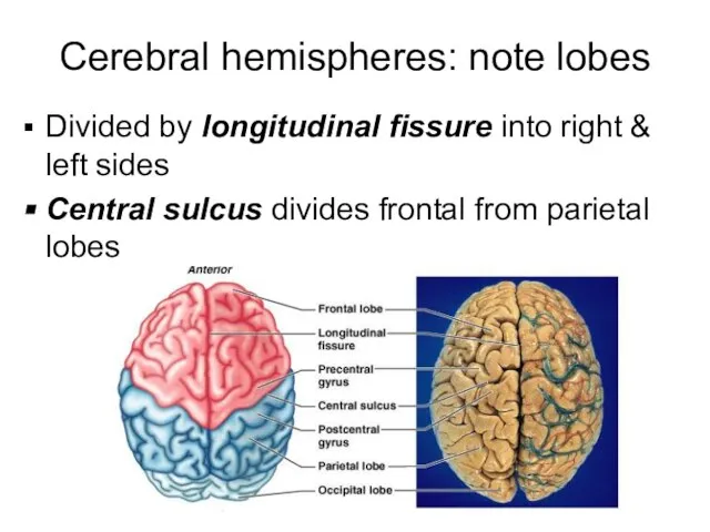 Cerebral hemispheres: note lobes Divided by longitudinal fissure into right & left