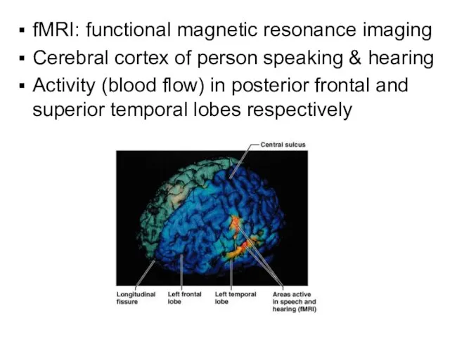 fMRI: functional magnetic resonance imaging Cerebral cortex of person speaking & hearing