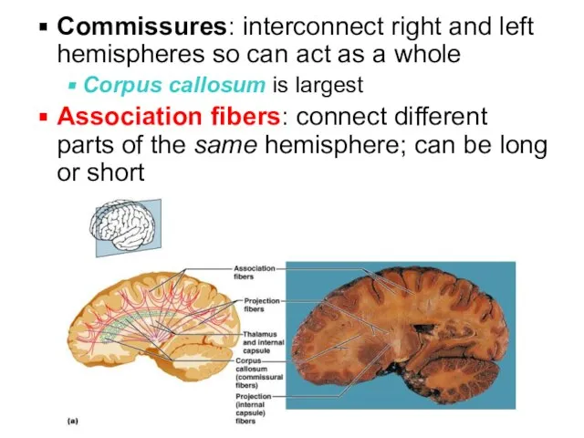 Commissures: interconnect right and left hemispheres so can act as a whole