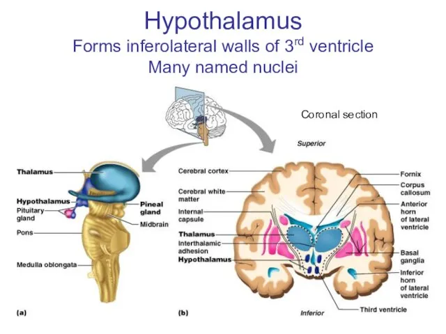 Hypothalamus Forms inferolateral walls of 3rd ventricle Many named nuclei Coronal section