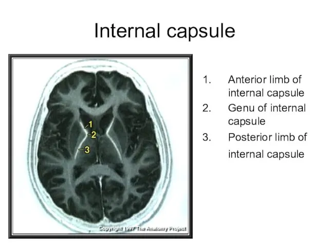 Internal capsule Anterior limb of internal capsule Genu of internal capsule Posterior limb of internal capsule