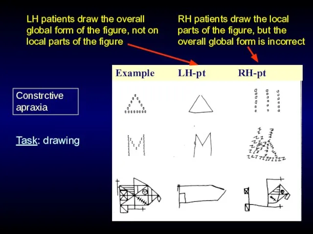 LH patients draw the overall global form of the figure, not on