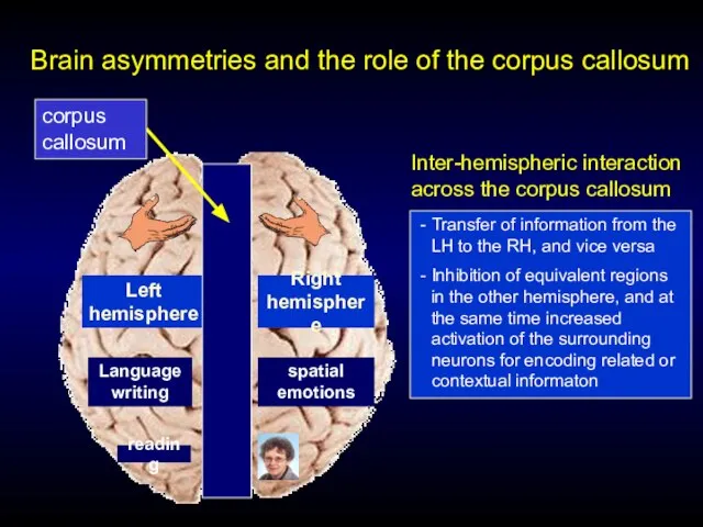 Brain asymmetries and the role of the corpus callosum Left hemisphere Right