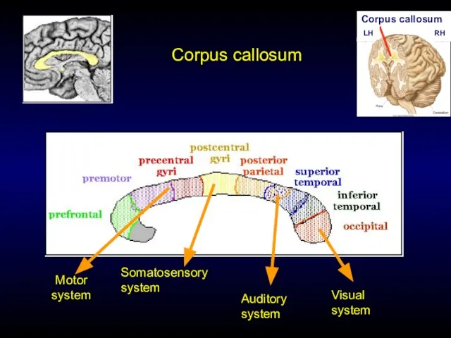 Corpus callosum Corpus callosum LH RH Visual system Motor system Somatosensory system Auditory system