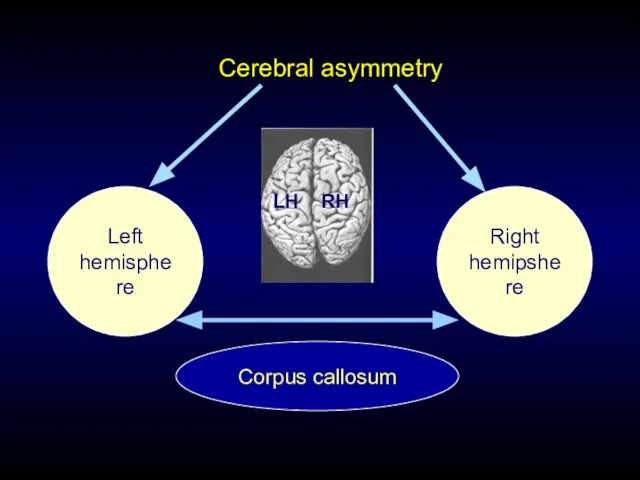 Cerebral asymmetry Left hemisphere Right hemipshere Corpus callosum RH LH