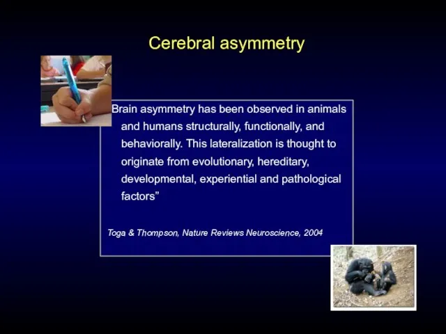 Cerebral asymmetry “ Brain asymmetry has been observed in animals and humans