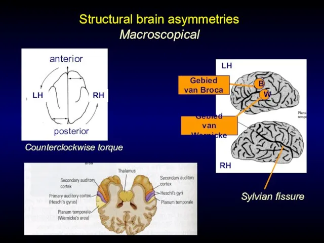 Structural brain asymmetries Macroscopical posterior anterior LH RH Counterclockwise torque Sylvian fissure