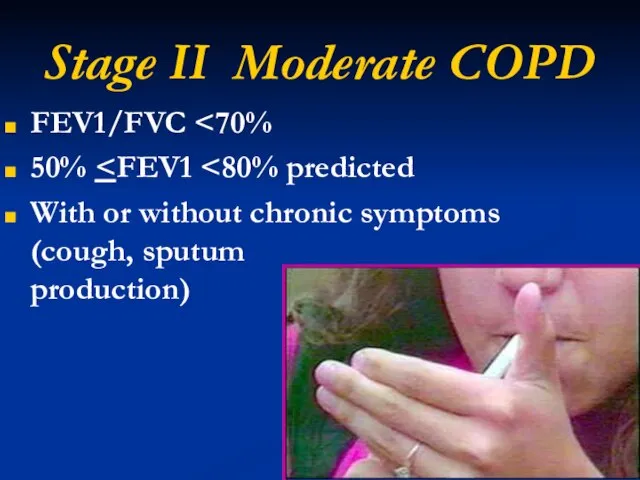 Stage II Moderate COPD FEV1/FVC 50% With or without chronic symptoms (cough, sputum production)