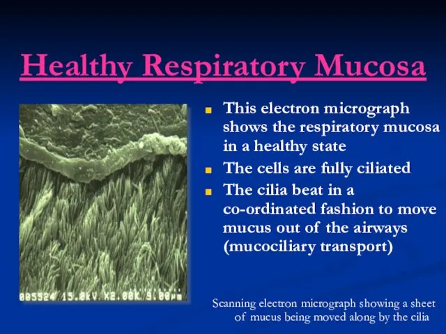 Healthy Respiratory Mucosa This electron micrograph shows the respiratory mucosa in a