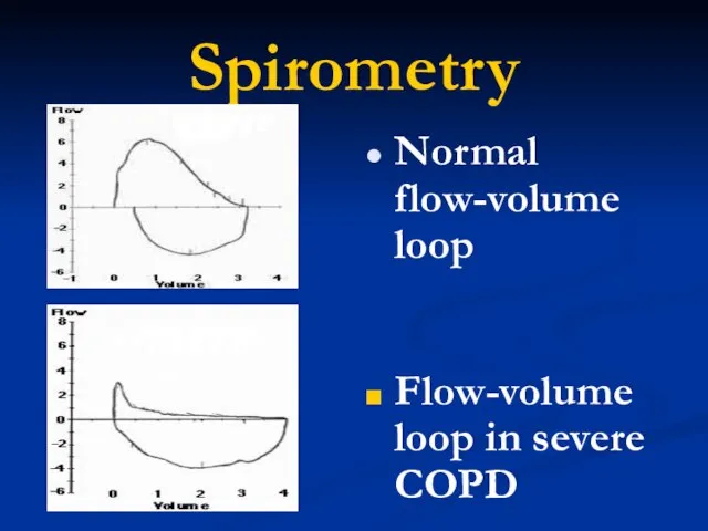 Spirometry Normal flow-volume loop Flow-volume loop in severe COPD