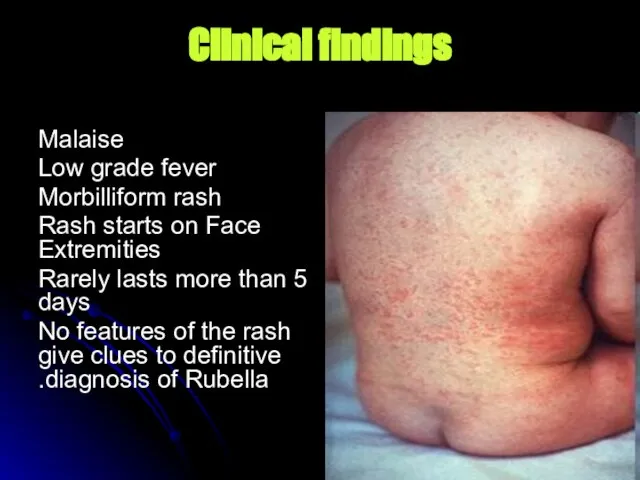 Clinical findings Malaise Low grade fever Morbilliform rash Rash starts on Face