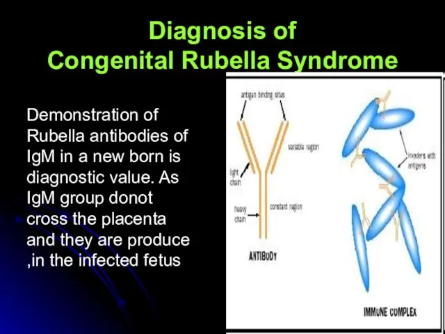 Diagnosis of Congenital Rubella Syndrome Demonstration of Rubella antibodies of IgM in
