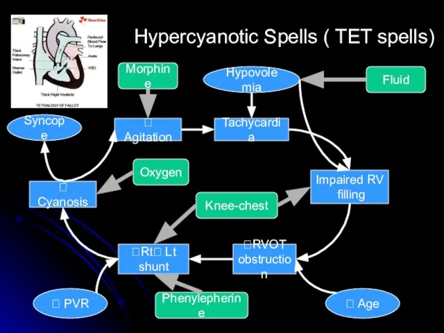 Tachycardia Impaired RV filling ?RVOT obstruction ?Rt? Lt shunt ? Agitation Hypovolemia