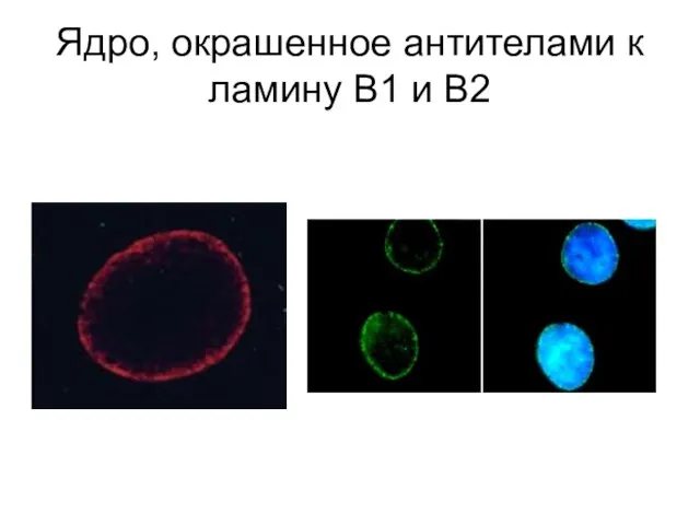 Ядро, окрашенное антителами к ламину В1 и В2