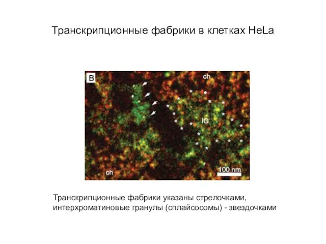 Транскрипционные фабрики в клетках HeLa Транскрипционные фабрики указаны стрелочками, интерхроматиновые гранулы (сплайсосомы) - звездочками