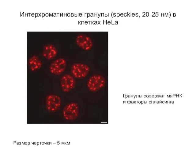 Интерхроматиновые гранулы (speckles, 20-25 нм) в клетках HeLa Размер черточки – 5