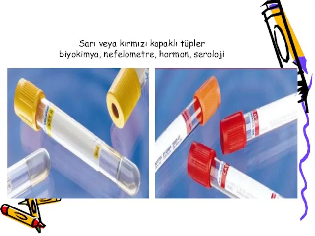 Sarı veya kırmızı kapaklı tüpler biyokimya, nefelometre, hormon, seroloji