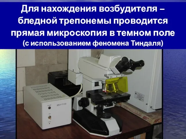 Для нахождения возбудителя – бледной трепонемы проводится прямая микроскопия в темном поле (с использованием феномена Тиндаля)