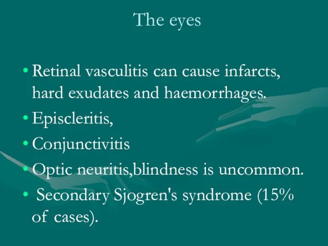 The eyes Retinal vasculitis can cause infarcts, hard exudates and haemorrhages. Episcleritis,