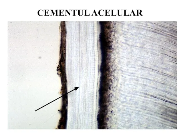 CEMENTUL ACELULAR