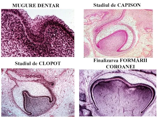 MUGURE DENTAR Stadiul de CAPISON Stadiul de CLOPOT Finalizarea FORMĂRII COROANEI