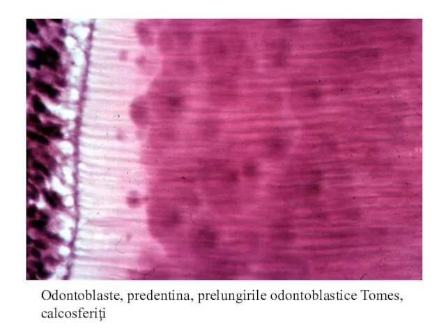 Odontoblaste, predentina, prelungirile odontoblastice Tomes, calcosferiţi