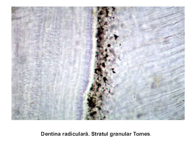 Dentina radiculară. Stratul granular Tomes.