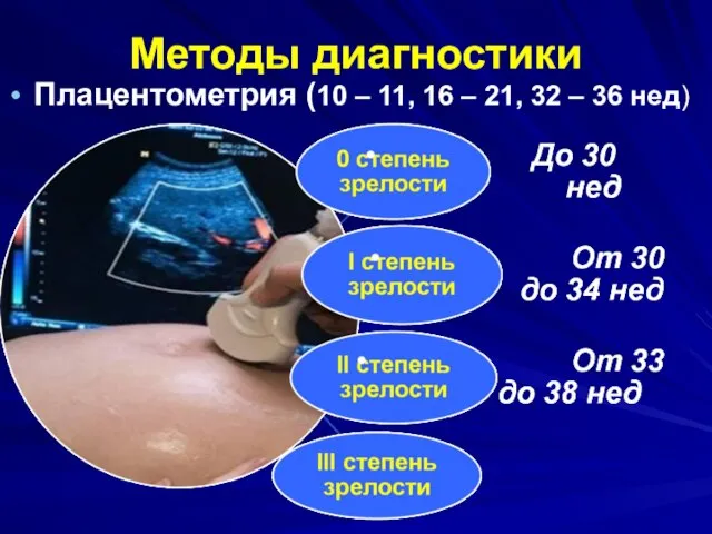 Методы диагностики Плацентометрия (10 – 11, 16 – 21, 32 – 36 нед)