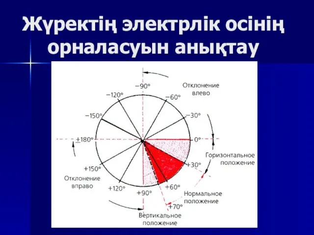 Жүректің электрлік осінің орналасуын анықтау