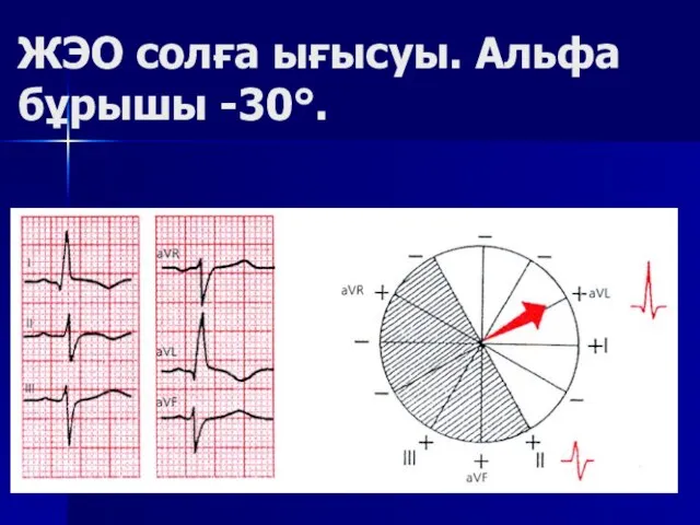 ЖЭО солға ығысуы. Альфа бұрышы -30°.