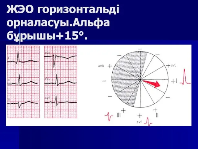 ЖЭО горизонтальді орналасуы.Альфа бұрышы+15°.