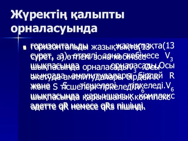 Жүректің қалыпты орналасуында горизонтальды жазықтықта(13 сурет, а) өтпелі зона көбінесе шықпасында орналасадыV3