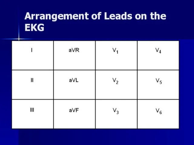 Arrangement of Leads on the EKG