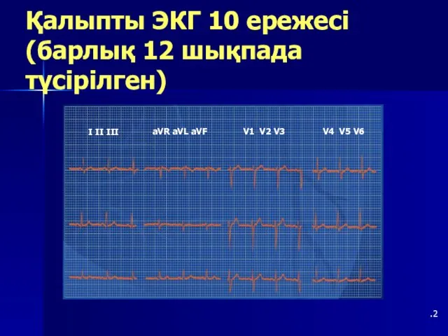 Қалыпты ЭКГ 10 ережесі (барлық 12 шықпада түсірілген) .2